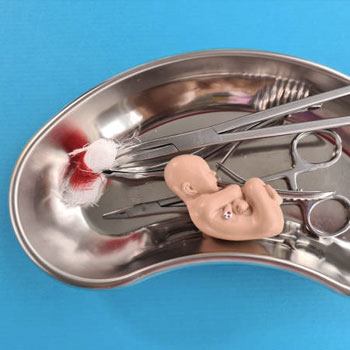 Previous Foetal Deaths treatment