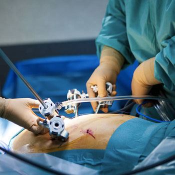 Lap. Hysterectomy in Krishna Hospital Samastipur